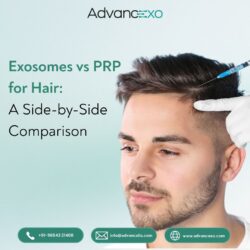 Exosomes vs PRP for Hair: A Side-by-Side Comparison