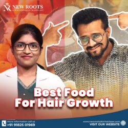 Best Foods for Hair Growth: Nutrition Tips for Healthy Hair