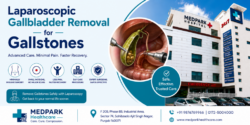 Laparoscopic Gallbladder Removal Surgery