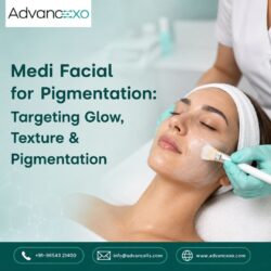 Medi Facial for Pigmentation: Targeting Glow, Texture and Pigmentation