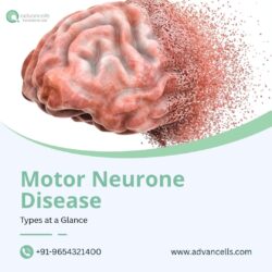 Motor Neurone Disease: Types at a Glance