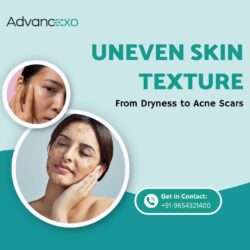 Uneven Skin Texture: From Dryness to Acne Scars