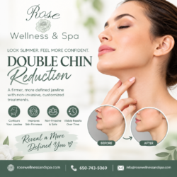 Double Chin Reduction – Enhance Your Jawline with Advanced Non-Surgical Treatments