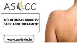 Best dermotology in Jaipur