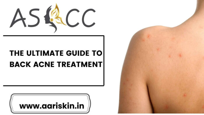 Best dermotology in Jaipur