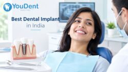 Best Dental Implant in India – YouDent Hospital, Jaipur